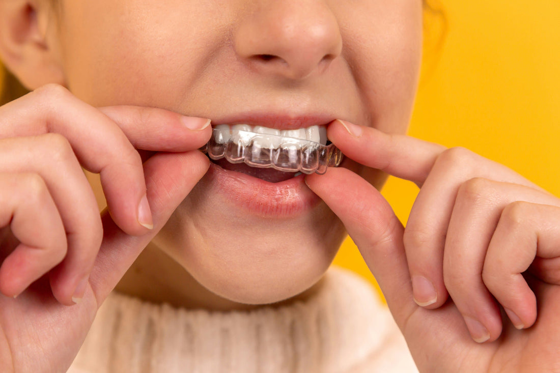 Clear Braces Price Guide: Types & What You Really Pay in 2026