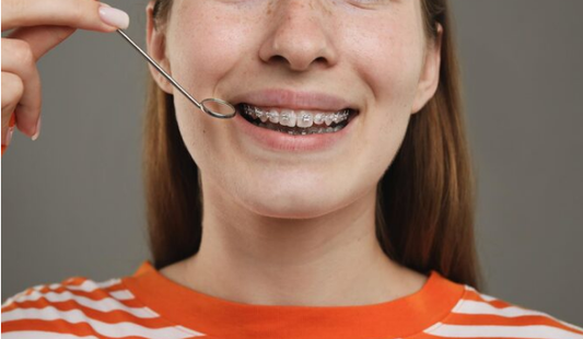 Teeth Shifting