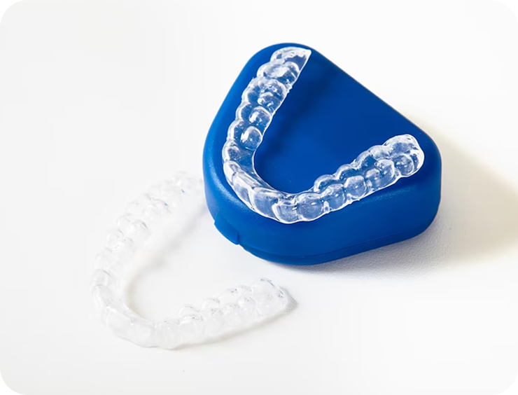 Aligner treatment plan by a UK Dentist
