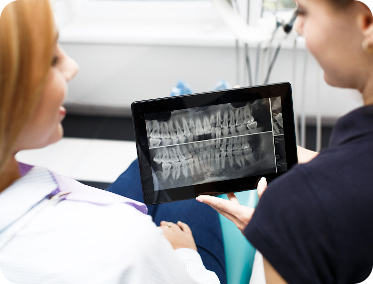 Aligner treatment plan by a UK Dentist